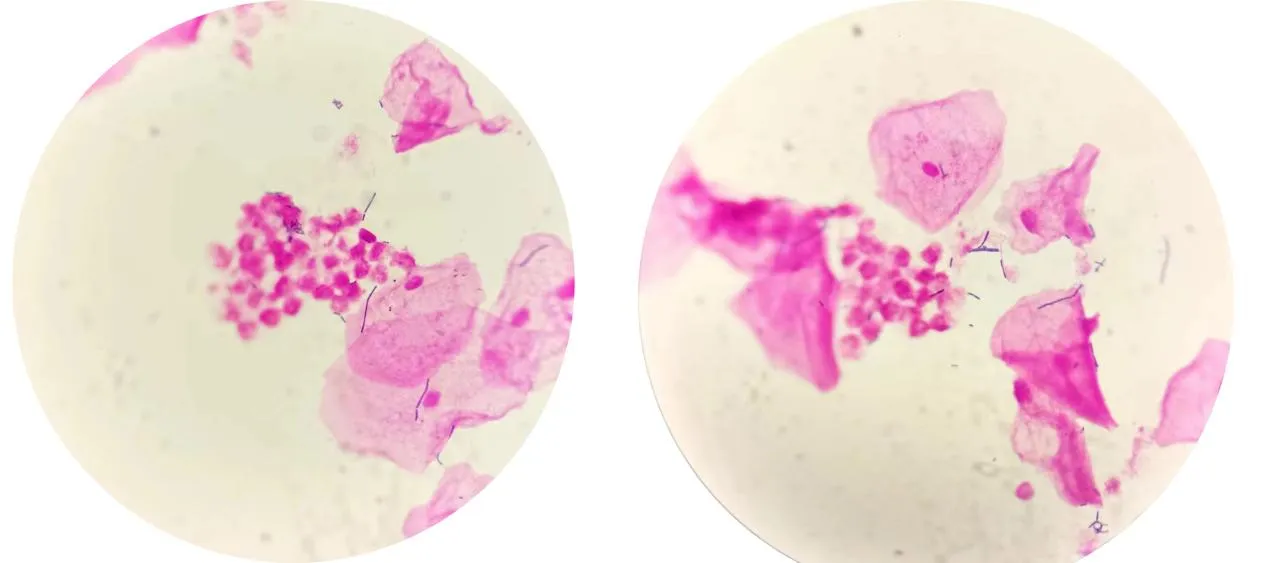 1750819216846409.jpg 3a816aff2c791016509545a8f0c5655e.jpg